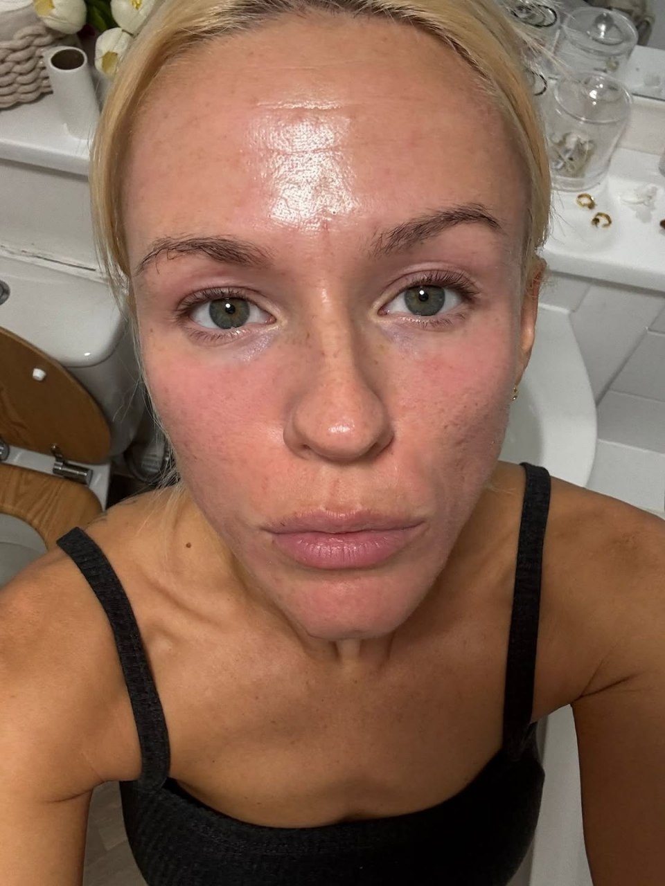 CO2 Laser After Treatment